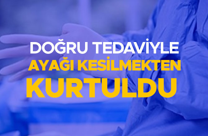 DOĞRU TEDAVİYLE AYAĞI KESİLMEKTEN KURTULDU 