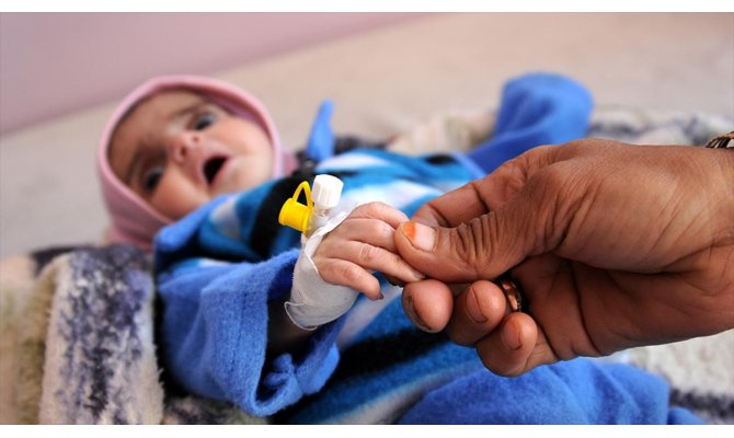 UNICEF: Yemen'de 12 milyon çocuk acil yardıma muhtaç