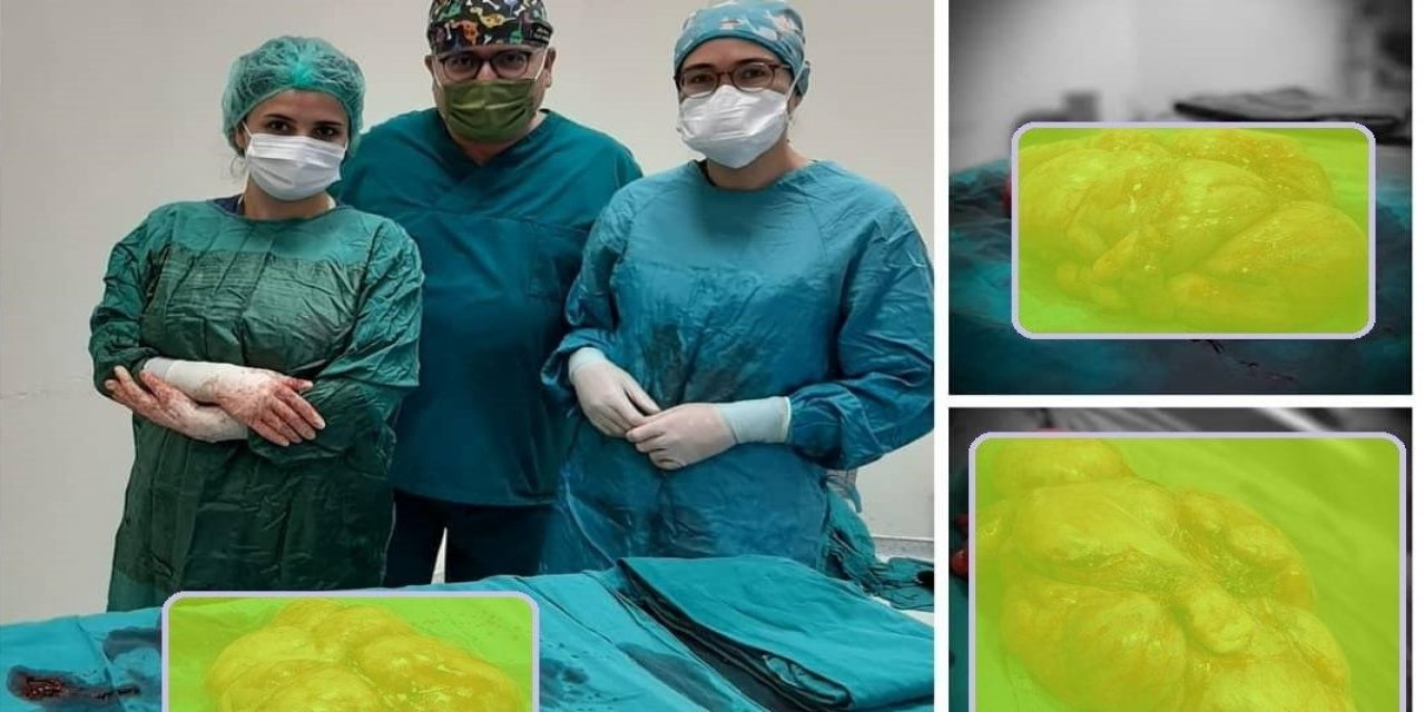 KSÜ’de başarılı operasyon! Tam 5 kilo 60 gram