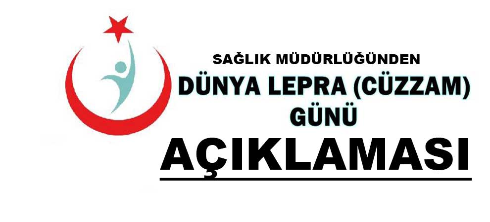 Sağlık Müdürlüğünden Dünya Lepra (Cüzzam) Günü Açıklaması